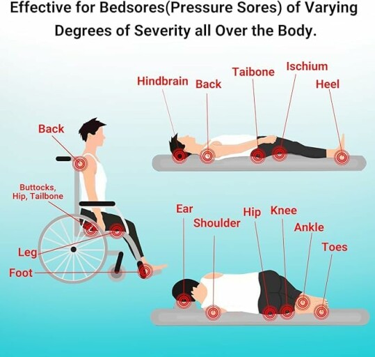 iShanCare Dekubitus-Creme Anwendung